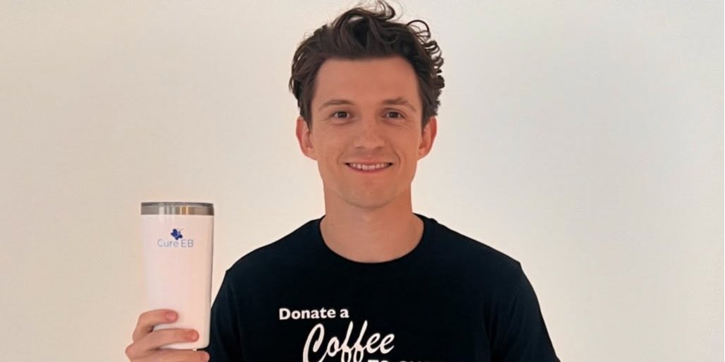 Том Голланд травмувався на&nbsp;зйомках фільму Людина-павук (Фото: tomholland2013/Instagram)